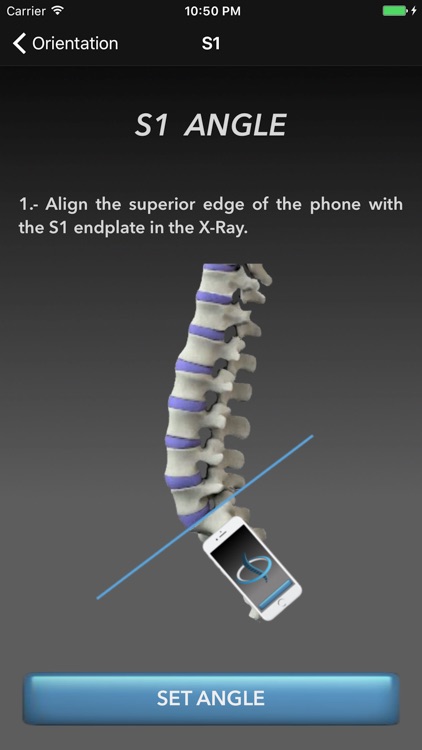 Sagittal Balance Advance LITE
