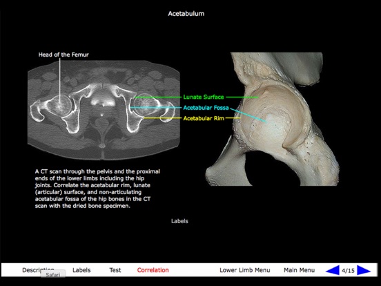 Gross Anatomy of the Skeleton iPad screenshot 10 - Medical app
