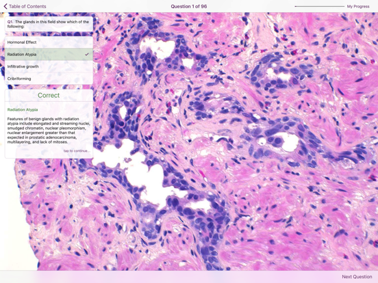 Hopkins Prostate Pathologyのおすすめ画像5