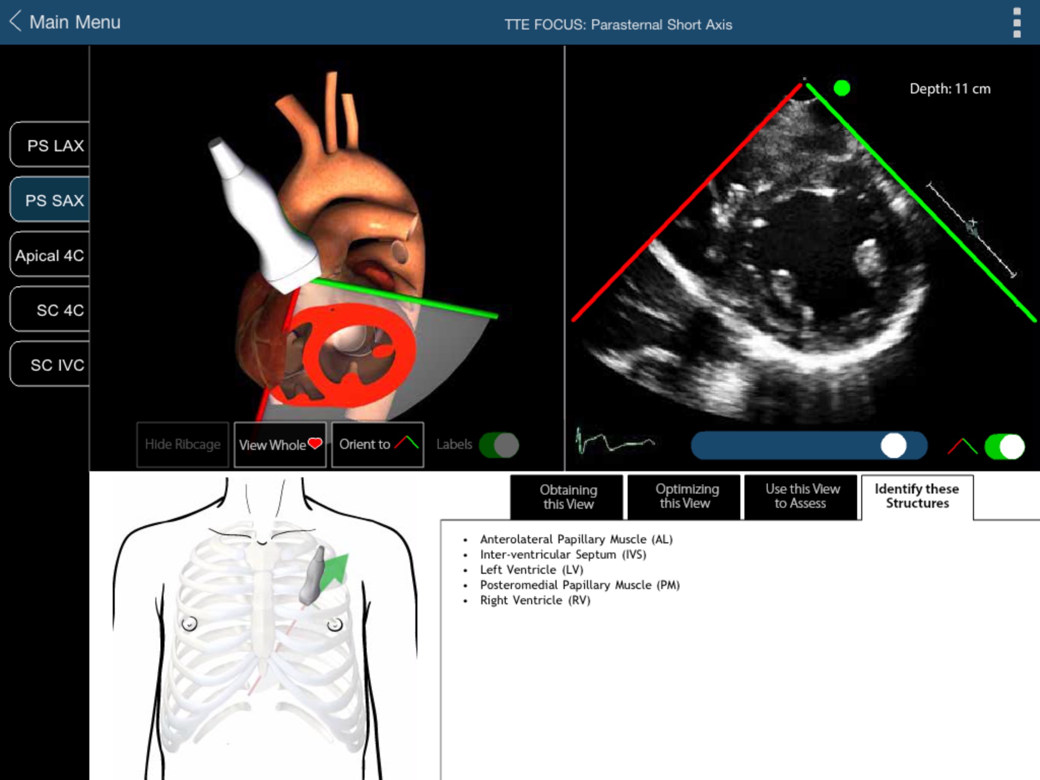 TTE FOCUS Views screenshot 2