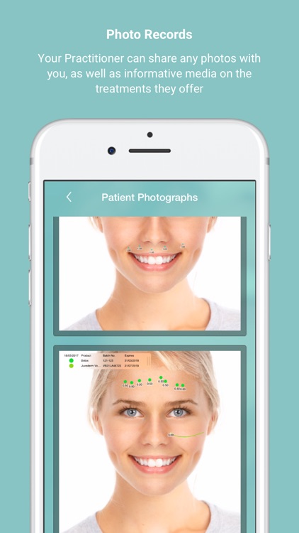 Consentz Patient App