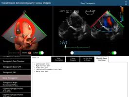 Game screenshot TEE Colour Doppler hack