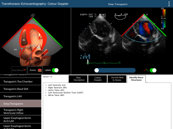 Screenshot #6 pour TEE Colour Doppler