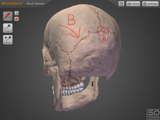 BoneBox™ - Skull Viewerのおすすめ画像3