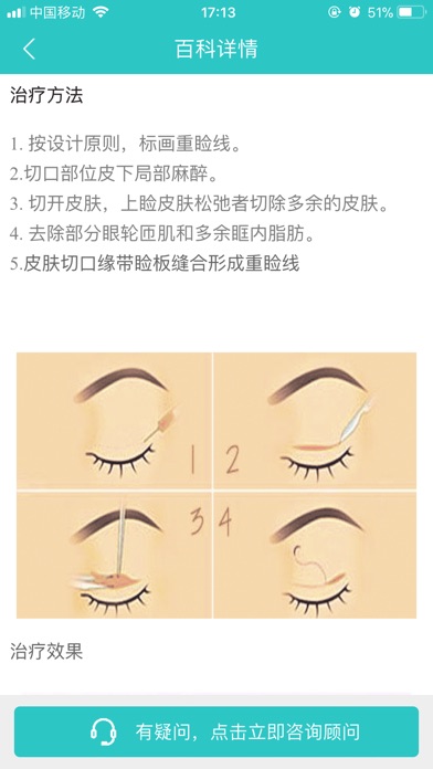 双眼皮整形-双眼皮整容咨询的专业app screenshot 3