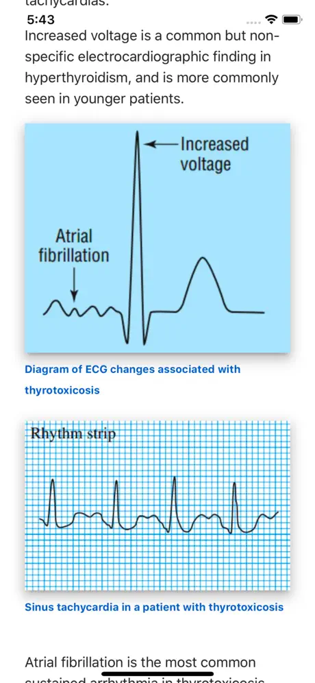 ECG Basics Lite: ECG Made Easy
