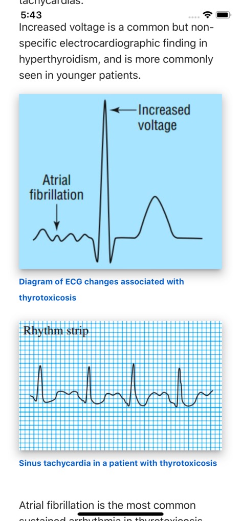 ECG Basics Lite: ECG Made Easy - Medical App | MWM