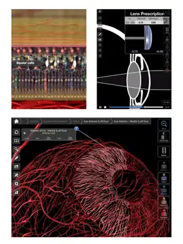 Game screenshot Essential Eye hack