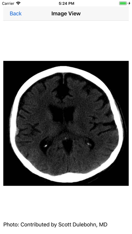 Neurosurgery Board Review screenshot-7