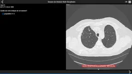 Game screenshot Fibrose pulmonaire 2017 mod apk