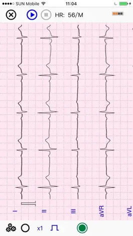 Game screenshot UltraLS   ECG SpO2 TEMP apk