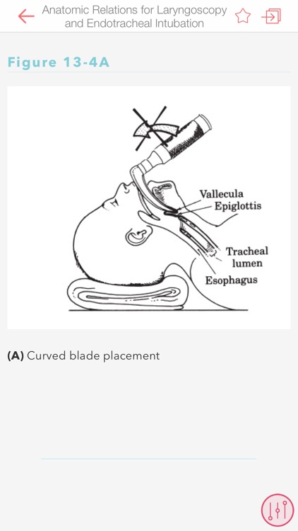 MGH HBK of Clinical Anesthesia screenshot-4