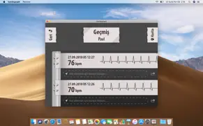 kardiyograf (cardiograph) iphone resimleri 3