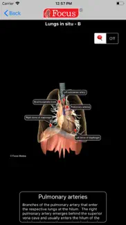 lungs - digital anatomy iphone screenshot 4