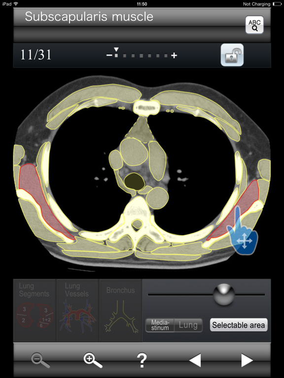 Chest CT Sectional Walkerのおすすめ画像4