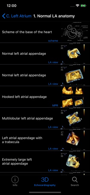 CARDIO3® 3D Echocardiography(圖2)-速報App