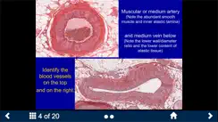 Histology Complete -SecondLook iPhone image 3