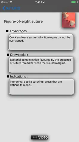 Game screenshot Suturing techniques Videos mod apk