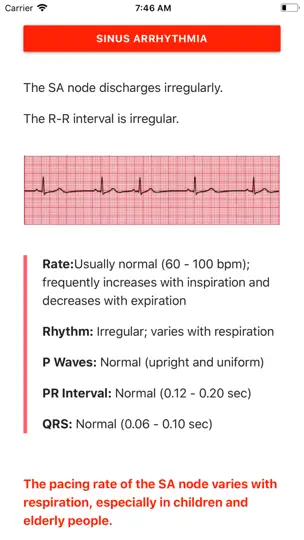 ECG FlashCards iPhone Screenshot 1