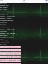 EKG Academy ipad bilder 1