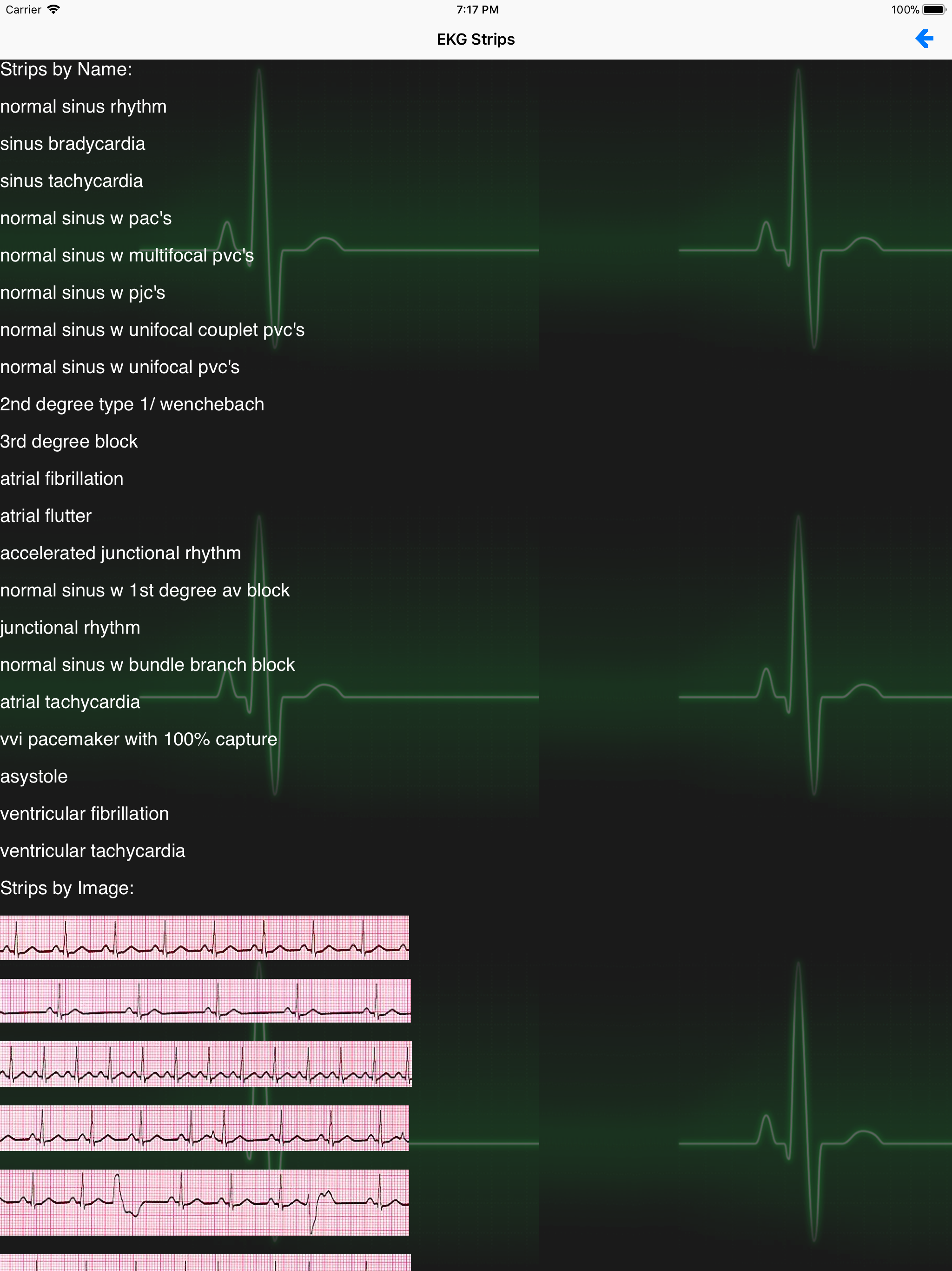 EKG Academy