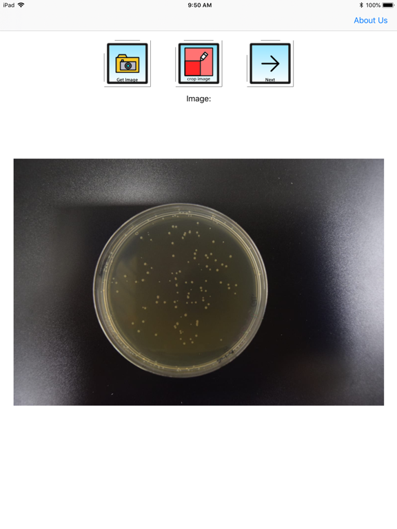 Screenshot #4 pour APD Colony Counter App PRO