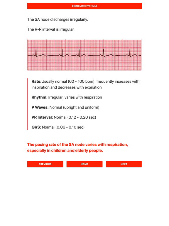 Screenshot #4 pour ECG FlashCards