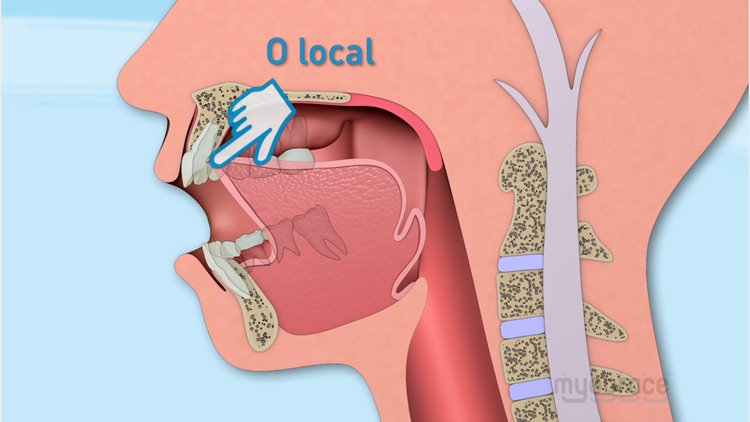 Atividades Myobrace PT