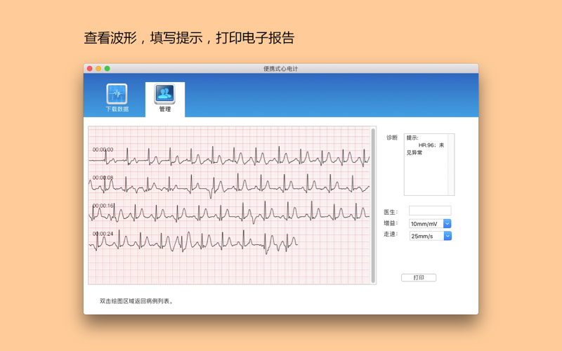 Portable ECG Monitor 缩略图 3