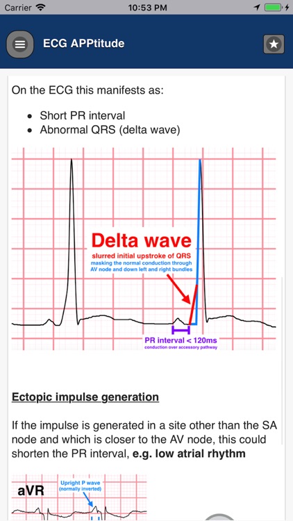 ECG APPtitude screenshot-3