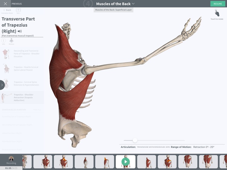 Undergrad Anatomy by Regions screenshot-4