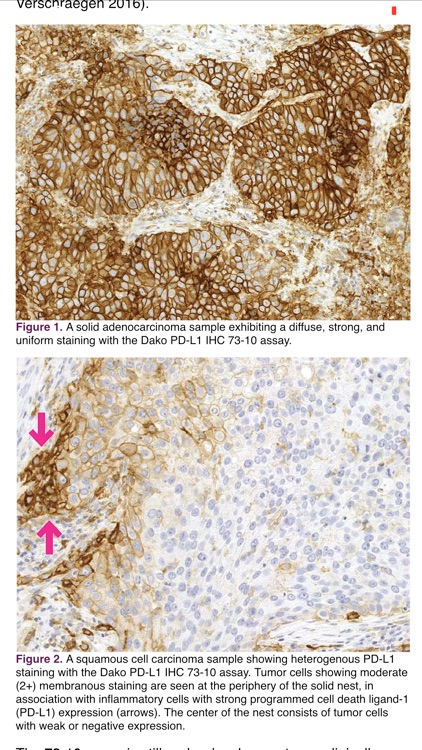 IASLC Atlas of PD-L1 Testing in Lung Cancer screenshot-3