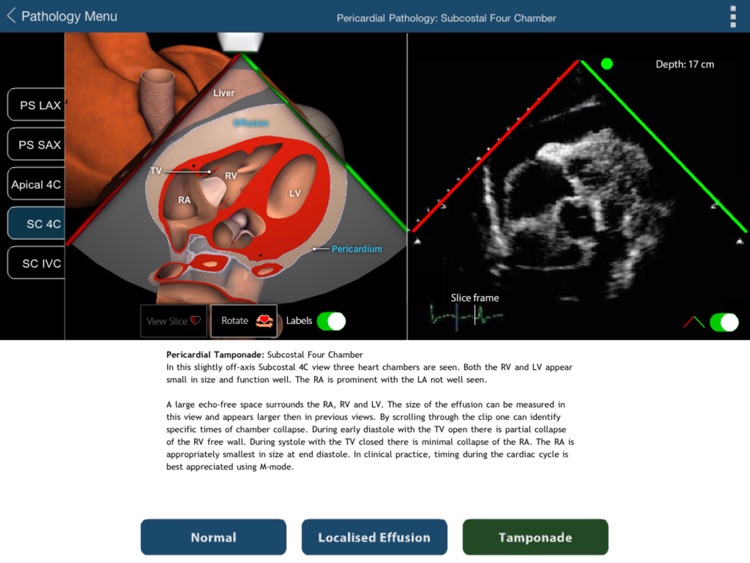 TTE FOCUS Views screenshot-3