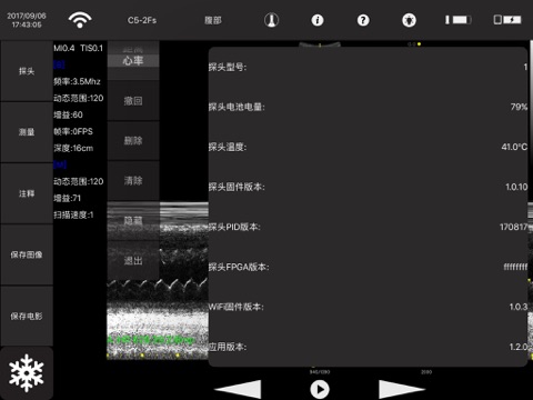 W-HandProbe screenshot 3