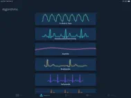 ACLS Rhythms and Quiz ipad bilder 0