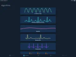 ACLS Rhythms and Quiz iPad image 1
