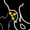 Radiographic evaluation of the acetabular morphology is paramount importance for diagnosis, treatment, and follow-up management in dysplasia of the hip in children