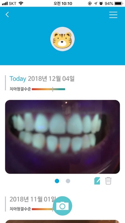 덴티노트(Dentinote)