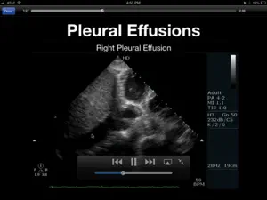 Trauma Ultrasound eBook screenshot #4 for iPad