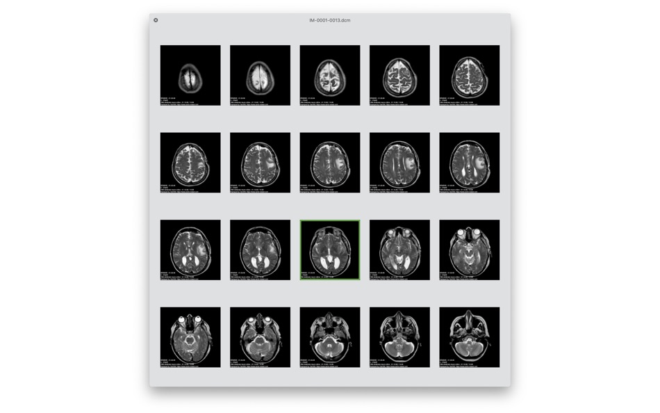 #4. DICOM Quicklook by OsiriX (macOS) 由: Pixmeo SARL