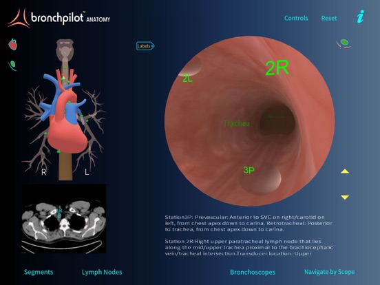 Screenshot #6 pour BronchPilot ANATOMY