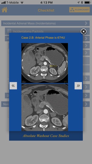 CTisus Adrenal Mass Checklist(圖4)-速報App