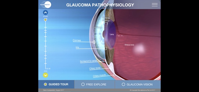 Glaucoma Education(圖4)-速報App