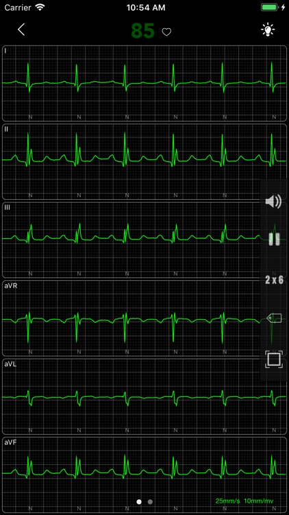 ECG - Cases for CME & EMT