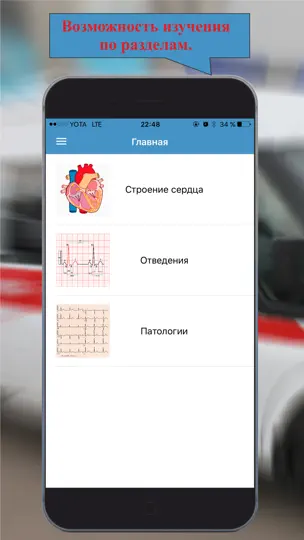Скриншот ЭКГ: Расшифровка и тесты. на iPhone 5