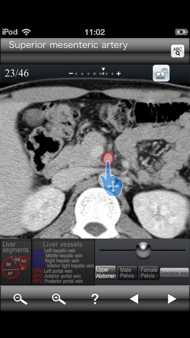 Abdominal CT Sectiona... screenshot1