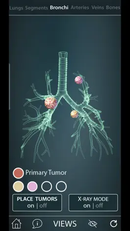 Game screenshot Surgical Anatomy of the Lung mod apk
