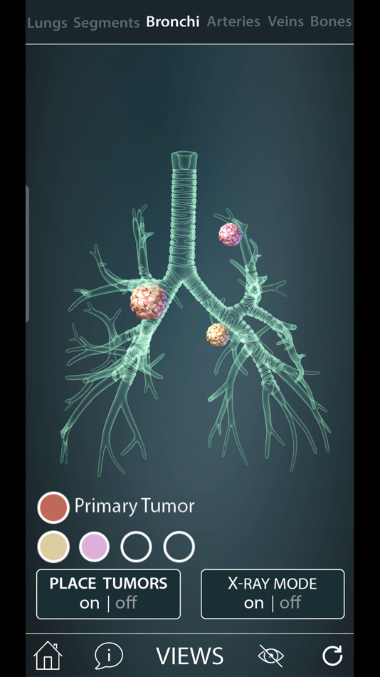 Surgical Anatomy of the Lung - 1.0 - (iOS)