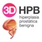O aplicativo 3D HPB é a ferramenta perfeita para os médicos que tratam pacientes dentro desta especialidade