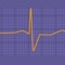 Calculator implementing the formula from the paper, "Electrocardiographic differentiation of early repolarization from subtle anterior st-segment elevation myocardial infarction," by Smith, et al